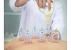 Best Cupping treatment in Soho