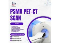 PSMA PET-CT Scan in Lucknow