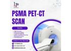 PSMA PET-CT Scan in Lucknow