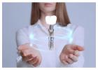 Looking for Reliable Dental Implant Parts Suppliers? Choose Siiodent Implants