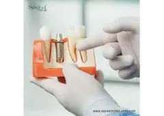 Complete Dental Implant Kits Nicaragua – Trusted Clinical Tools