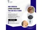 Non-Surgical Lipoma Treatment You Can Use at Home