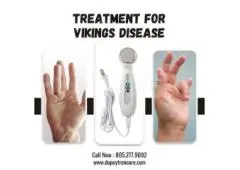 Best Home Treatment for Vikings Disease – Dupuytren’s Wand