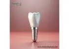 Dental Implant Manufacturers in Mexico Driving Innovation