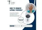 How to Remove a Lipoma Yourself Naturally?