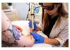 Laser Tattoo Removal Near Me Altamonte Springs.