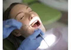 Dental Implants in Auckland
