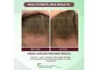 Natural Hair Loss Treatments That Are Worth Trying