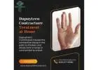 Non-Surgical Dupuytren Contracture Treatment at Home