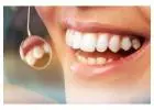 Teeth Whitening in Mount Roskill