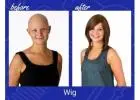 Hair Solutions for Hair Loss After Chemo Treatment