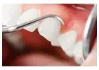 Comprehensive Oral Surgery Treatments with Precision | Potomac Perio Implant