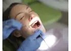 Dental Implants in Auckland