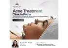 Best Acne Treatment in Patna