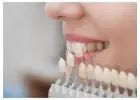 Where To Find Porcelain Veneers Melbourne For Natural Dental Results?
