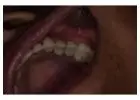 Get that Ideal Smile Makeover from the Best Tijuana Dentist
