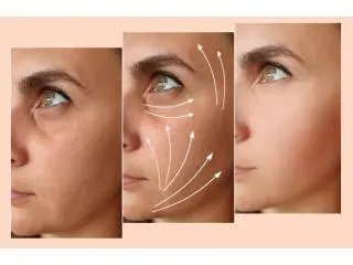 Rejuvenate Your Look with an 8 Point Liquid Facelift – No Surgery, Instant Lift! Rejuvenate Your Look with an 8 Point Liquid Facelift – No Surgery, Instant Lift!