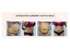 Liposuction Surgery Cost in Delhi: What’s Included and What’s Not