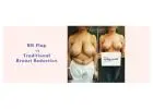 Signs You May Need Breast Reduction Surgery
