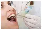 Root Canal Treatment in Mount Roskill, Auckland