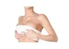 Breast lift surgery cost in Delhi - Dr Rajat Gupta