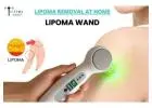 Lipoma Removal at Home – Non-Surgical Solution by Lipoma Wand