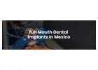 Full Mouth Dental Implants in Mexico with Teeth Savers