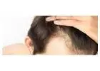 Hair Transplant in Ghaziabad