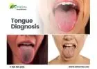 Tongue Diagnosis for Holistic Health Insights | DrMatina