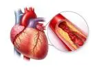 CT Coronary Angiography Near Me: Cost, Benefits & Test Details