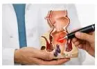 Specialized Treatment Care for Piles Fissure and Digestive Issues Delhi | Centre For Piles & Fistula