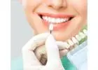 What Is the Difference Between Single Tooth Implants, Implant Bridges, and All-on-4: Which Is Right
