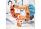 Trusted Colorectal Surgeons for Advanced Treatment