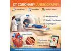 CT Coronary Angiography Price Guide: Factors, Cost Insights & What to Expect