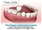 Restore Your Smile with Crowns and Bridges