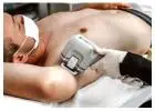Best Laser Hair Removal Clinic in Moonee Ponds