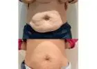 Best Body Contouring clinic in Berwick