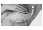 Non Surgical Breast Lift London With Harley Surgical Group Specialists