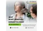 Best Wart Removal Dermatologist In Hyderabad | Dr. Venus
