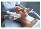 laser hair removal near me