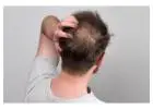 hair loss treatment for men