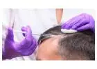 Prp Hair Treatment Near Me