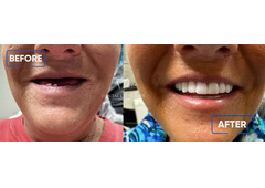 IV Sedation Dentistry Lexington