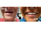 IV Sedation Dentistry Lexington