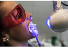 Philips Zoom Whitening in Mount Roskill