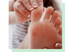 Ingrown Nail Removal Elizabeth