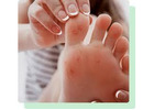 Ingrown Nail Removal Elizabeth