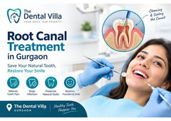 Root Canal Treatment in Gurgaon​