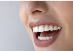 Tooth Color Fillings Auckland